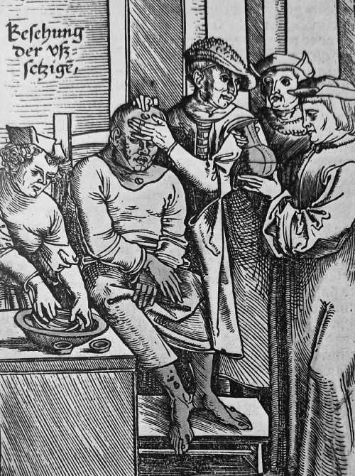 Diagnóstico de la lepra en el siglo XVI, una de las enfermedades en la Edad Media.